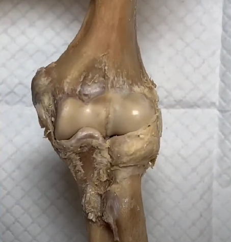 Madan Mohan Malviya Government Ayurved College, Udaipur, Rajasthan campus view 14