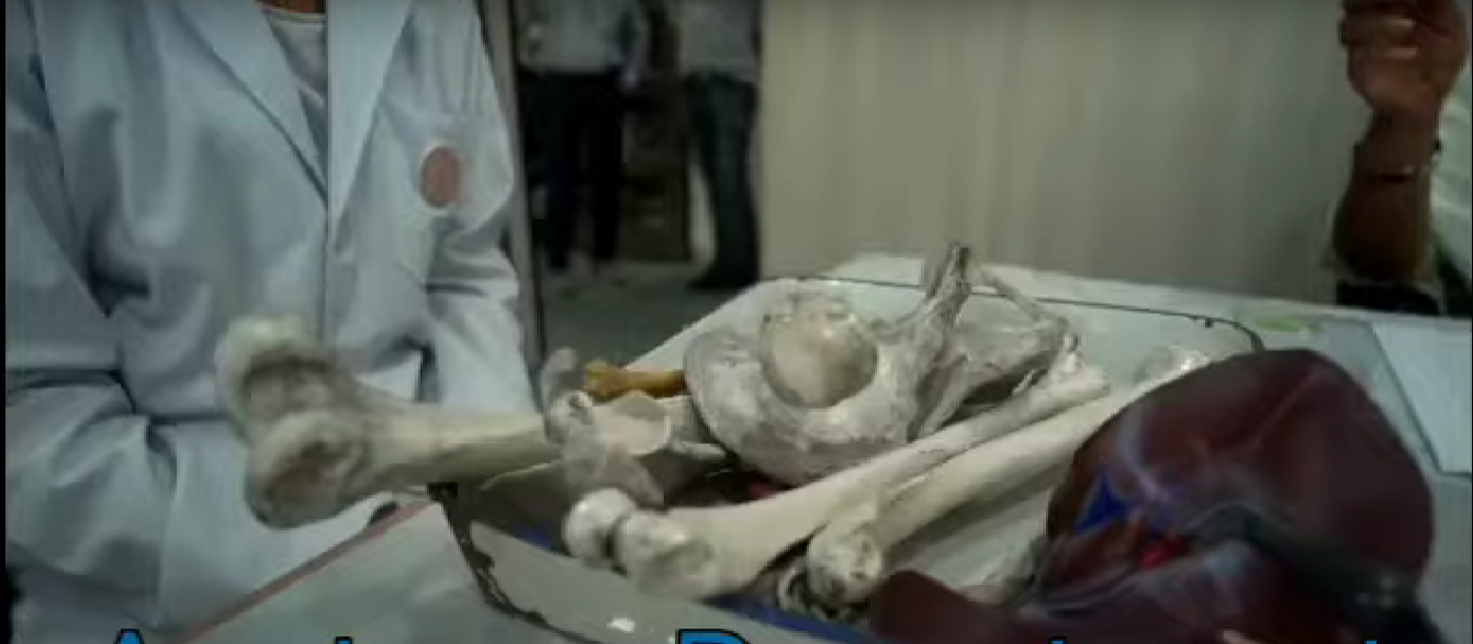 Govt. Astanga Ayurvda Mahavidyalaya, Indore, MP  campus view 4