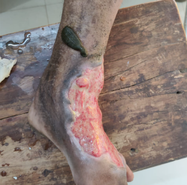  Government Ayurved College, Rewa, Madhya Pradesh campus view 11